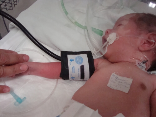 HTA en enfermedades renales