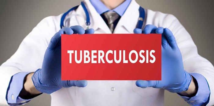 tratamiento de la tuberculosis
